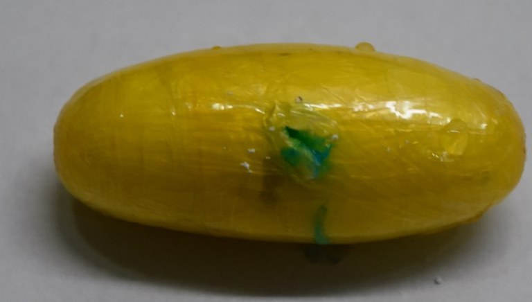 Drogas-no-estomago-Agencia-PF-3 PF prende duas passageiras com droga em cápsulas no aparelho digestivo
